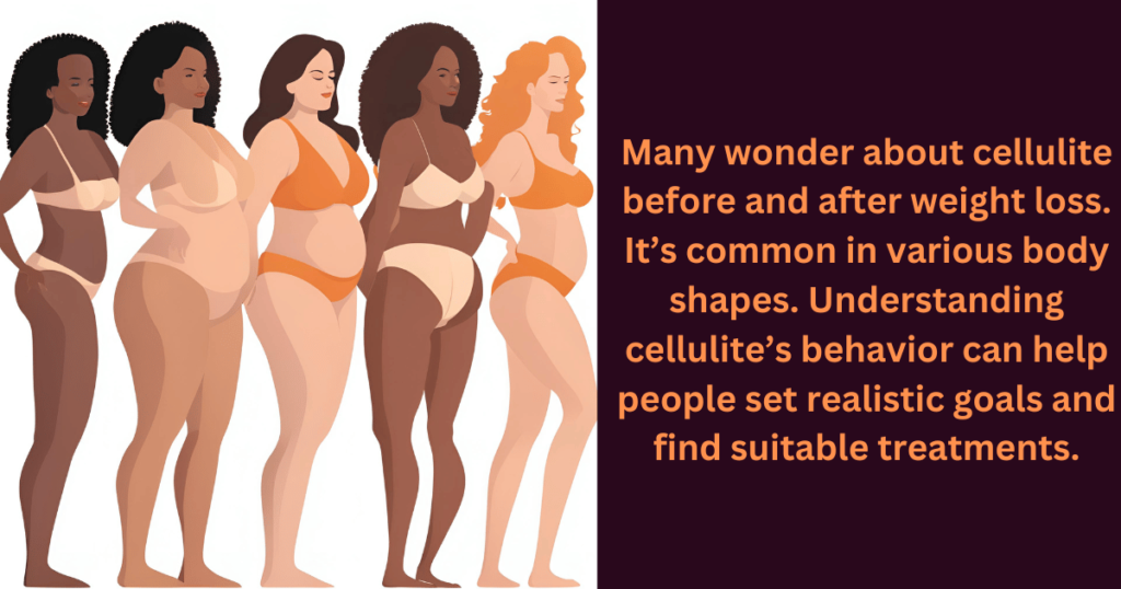 cellulite-before-and-after-weight-loss